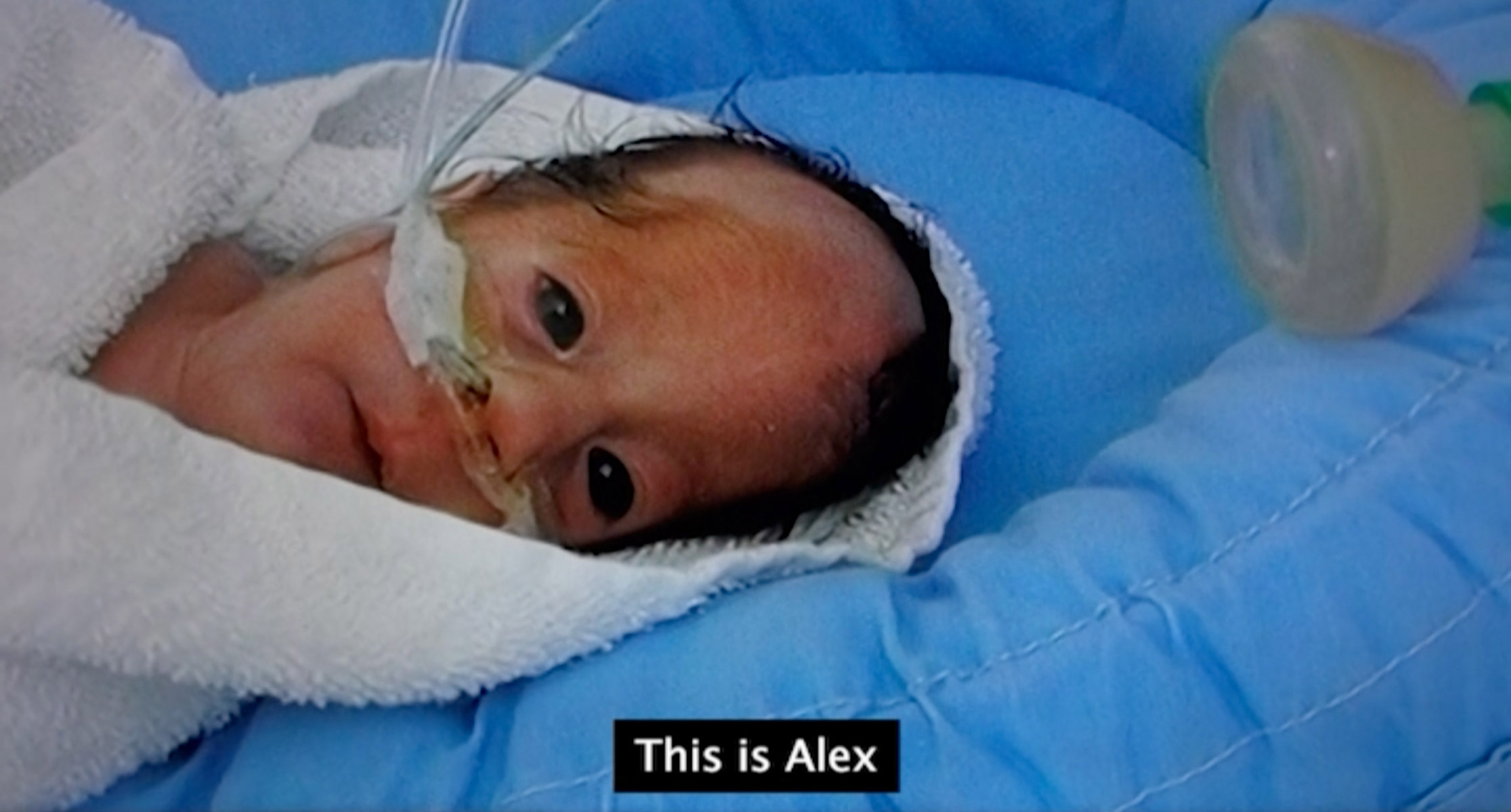 Still image of Alex as a very young baby in hospital, subtitle, this is Alex